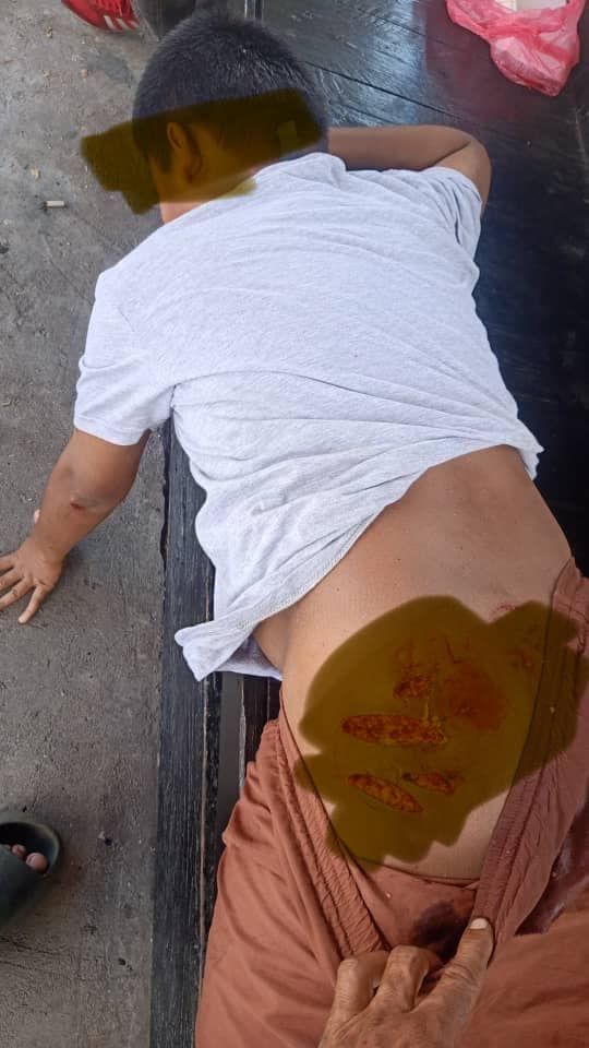 Kes Serangan Anjing Berpemilik. Ini Adalah Kes Ser..