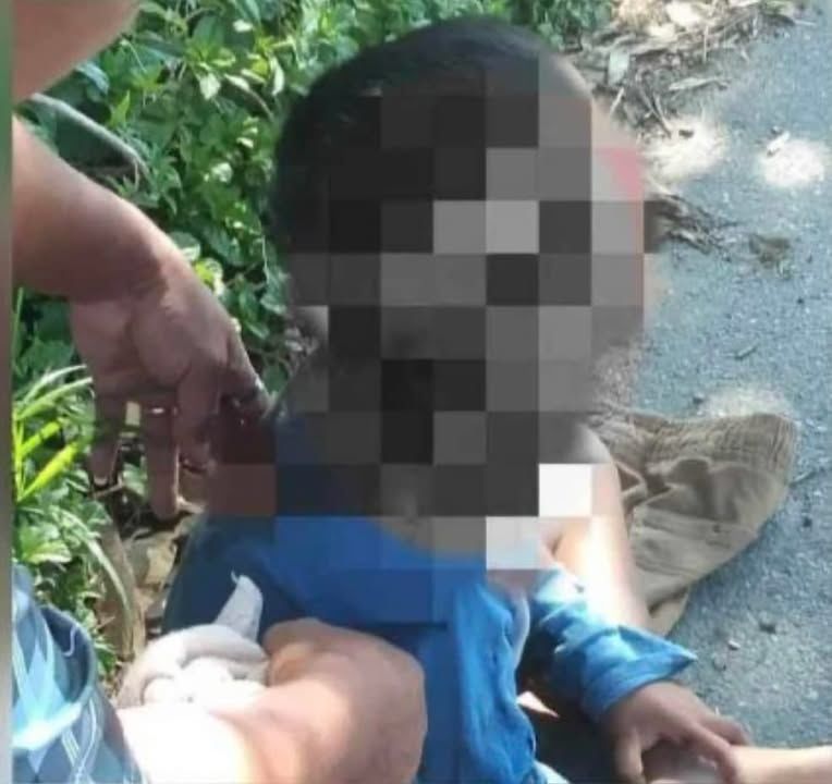 Serangan Anjing Kedua Awal Tahun 2025 Kali Ini Mel..